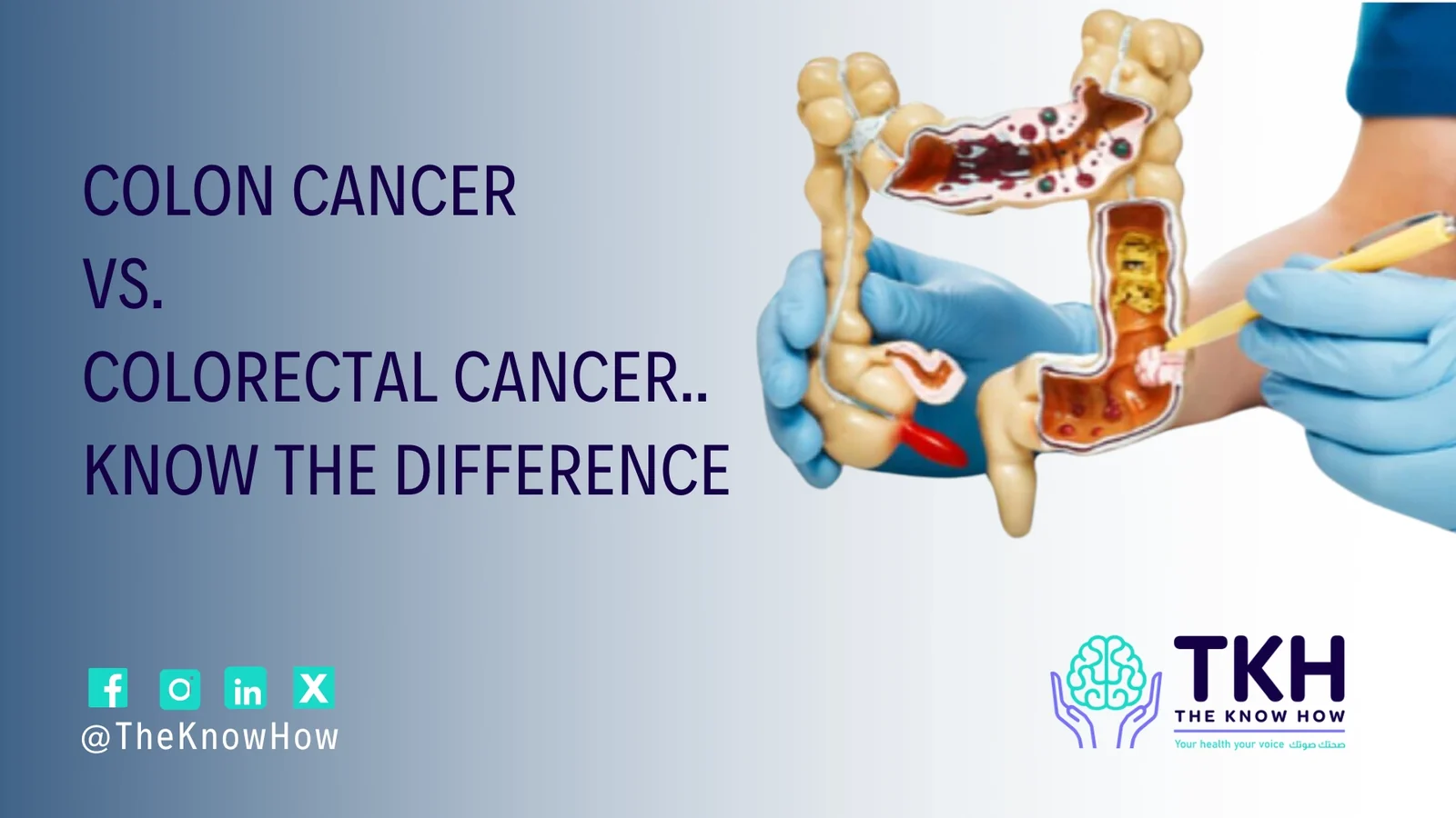 Colon cancer vs. colorectal cancer: Know the difference