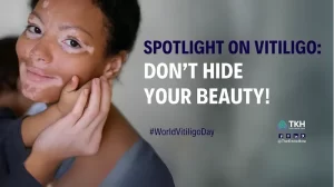 World Vitiligo Day