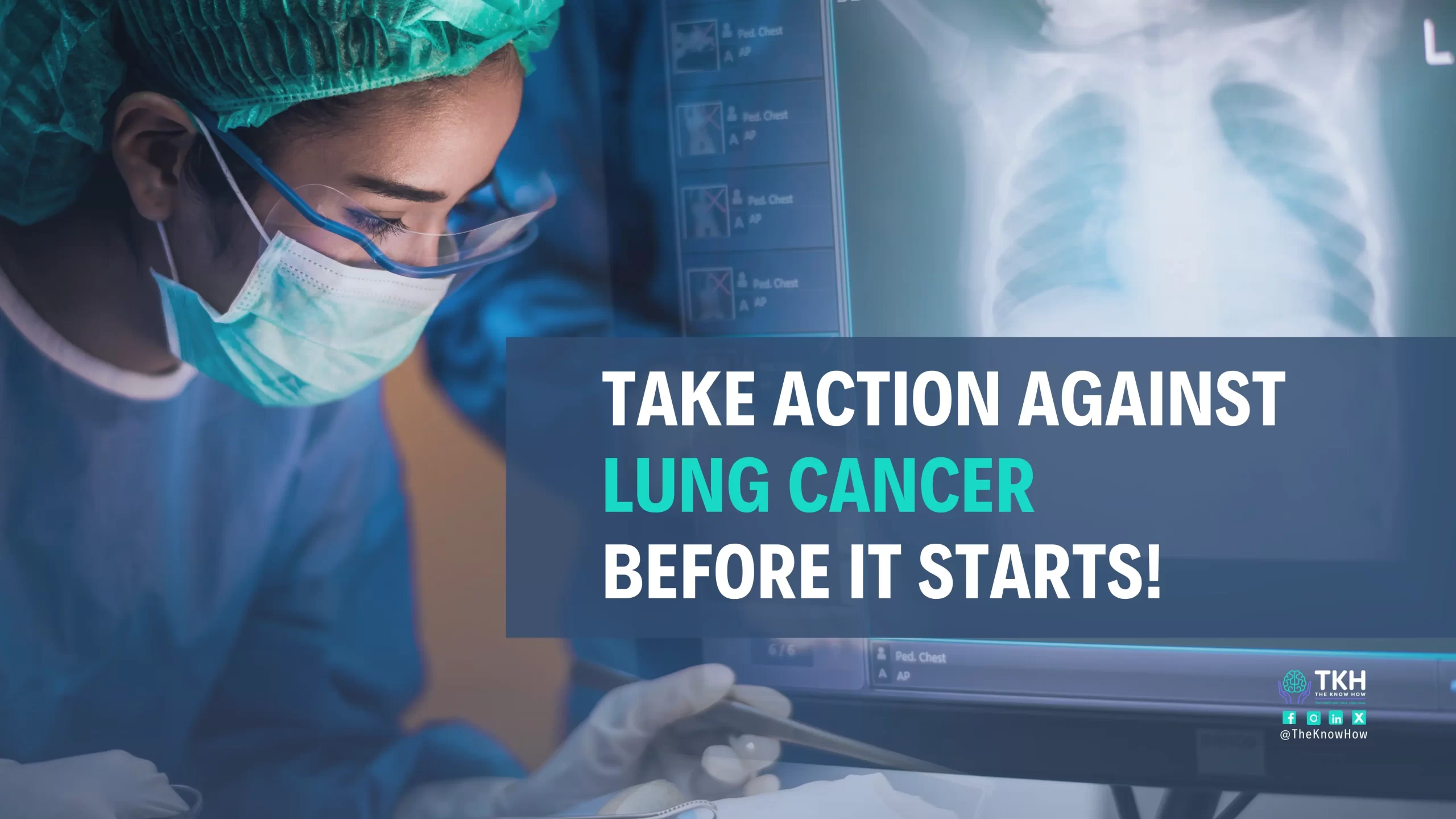 Lung Cancer