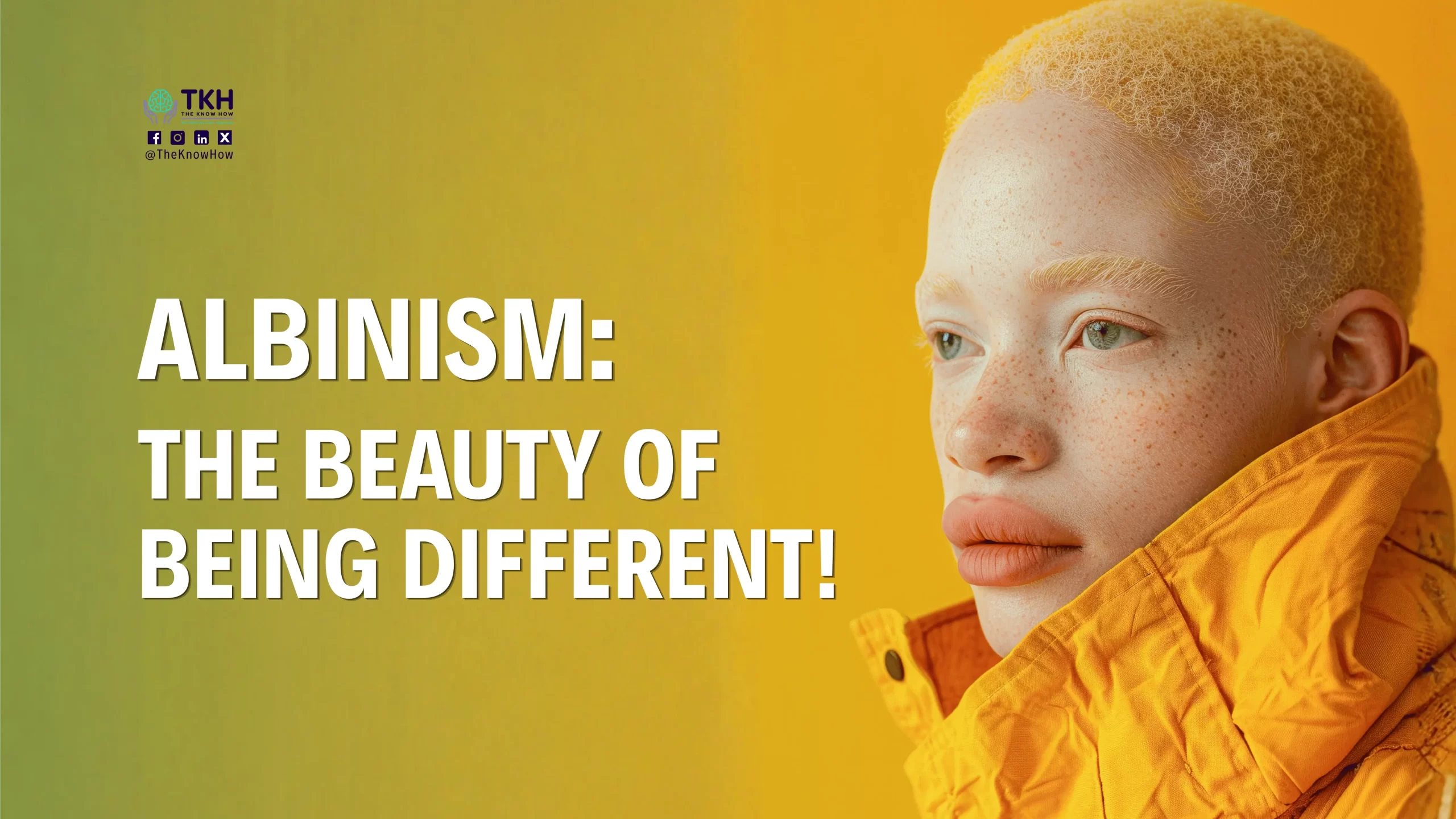 International Albinism Awareness Day 2026 promoting inclusion, dignity, equality, and awareness for people with albinism under the theme "Proudly In My Skin: Celebrating All Skin Tones."